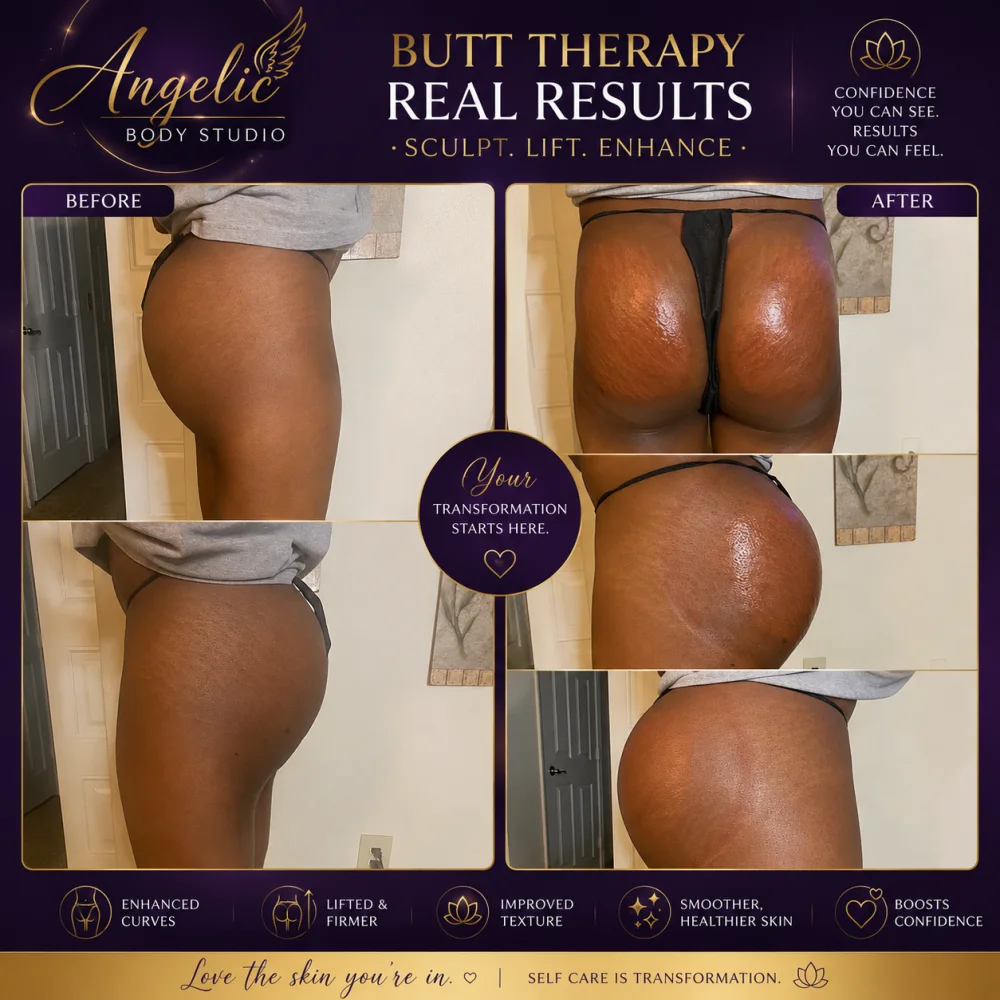 Body sculpting results